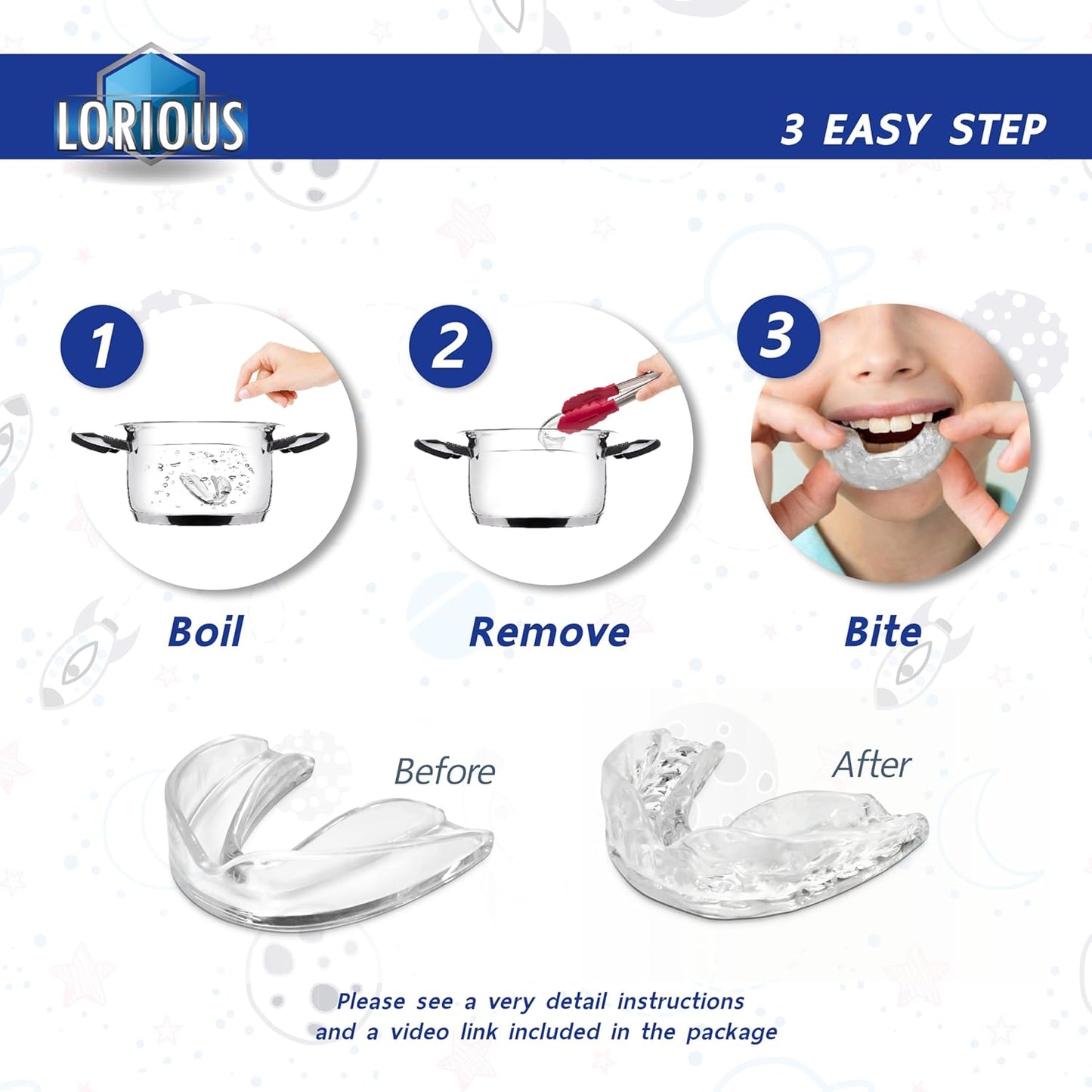 Moldable Mouthguard Custom Fit for Grinding Teeth & Clenching Night & Day Protection Pack of 6 in 2 Sizes for Kids & Small Mouths